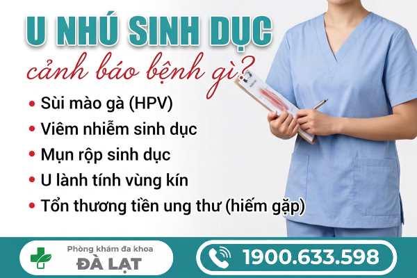 Hình ảnh minh họa
